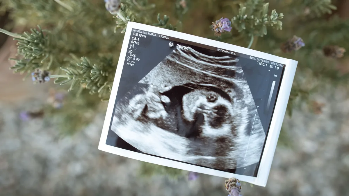 Close-up of an ultrasound image placed on a natural background.