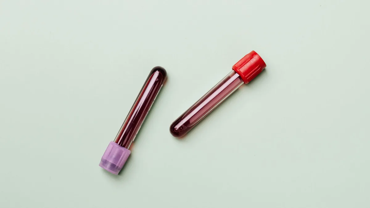 Blood samples in test tubes on a light background.