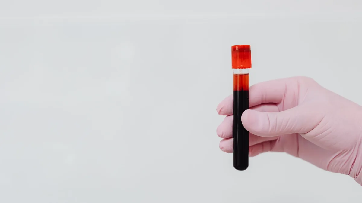 A gloved hand holding a blood sample in a test tube with a white background.