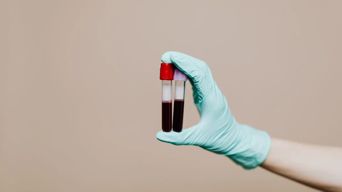 Close-up of a gloved hand holding two blood sample tubes in a laboratory setting.