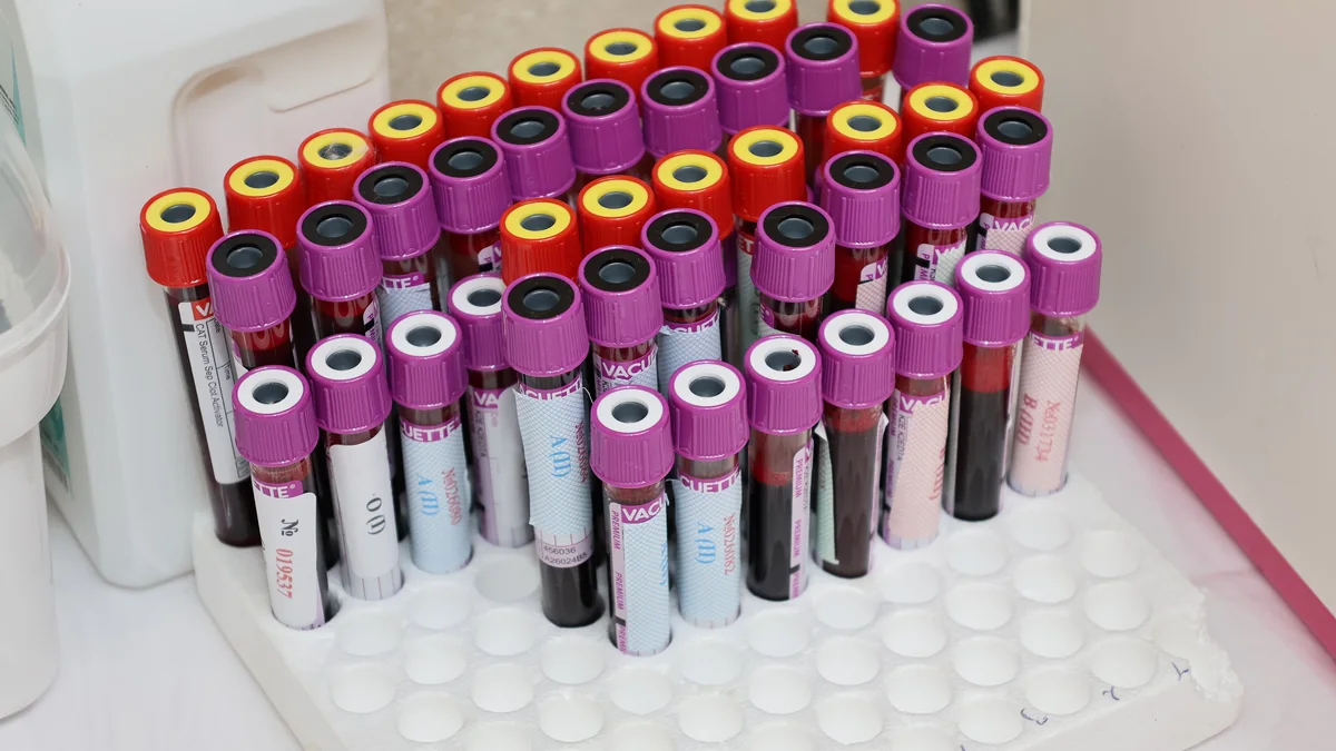 Rack of capped blood collection tubes standing in a laboratory tray