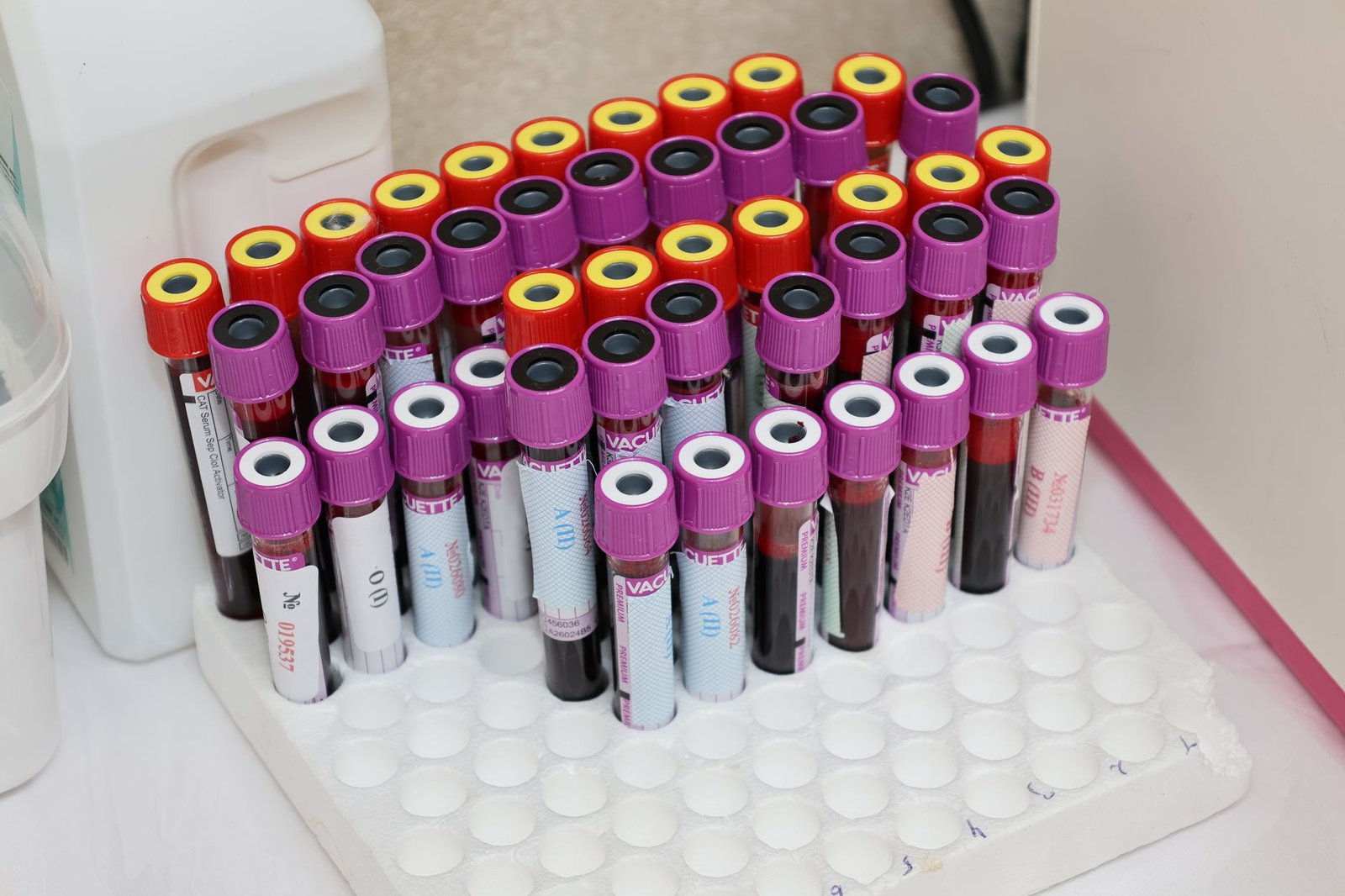A rack of capped blood collection tubes on a laboratory bench, labeled and waiting for analysis