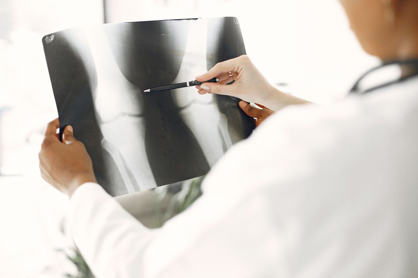 A clinician holding a knee radiograph up to the light and pointing at the joint line with a pen