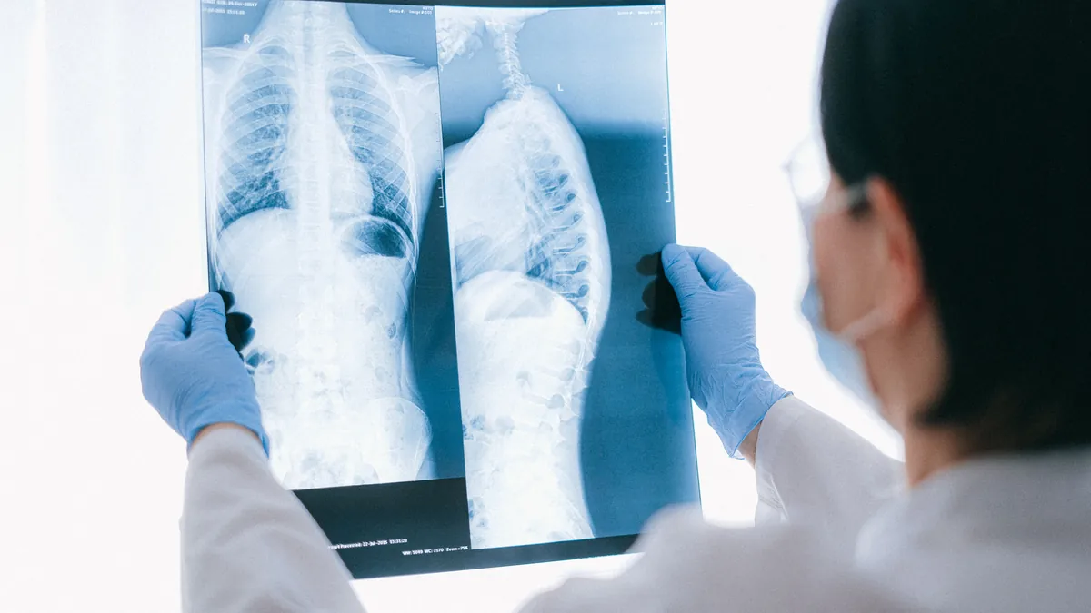 Gloved clinician holding up an X-ray film that shows the spine