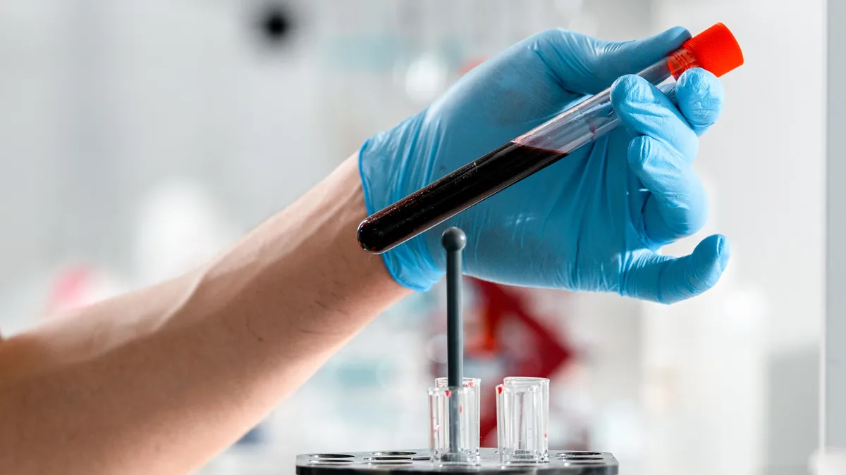 Gloved hand holding a tube of blood drawn for a uric acid and metabolic panel