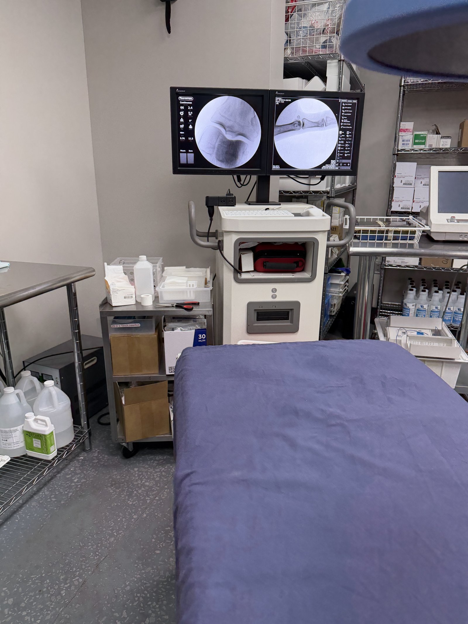 Fluoroscopic imaging monitors above the procedure table at Regen.MD, St. Louis